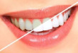 Tự tin hơn với những mẹo làm trắng răng, giúp răng chắc khỏe và khỏe mạnh hơn