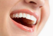 Tự tin hơn với những mẹo làm trắng răng, giúp răng chắc khỏe và khỏe mạnh hơn
