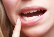 Răng hàm bị lung lay thì phải làm sao để chắc lại?