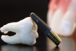 Trồng răng implant có nguy hiểm không? Giải đáp từ chuyên gia