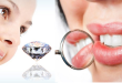 Tìm hiểu quy trình đính răng kim cương AN TOÀN – ĐẸP tại nha khoa