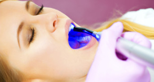 Xóa tan nỗi lo tẩy trắng răng bằng laser có hại không? Cùng xem bài này 