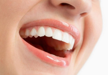 Làm gì để răng trắng hơn câu trả lời từ chuyên gia