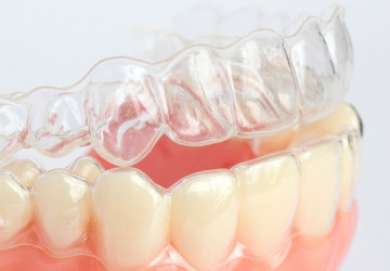 Niềng răng tháo lắp có hiệu quả không? Bs nha khoa giải đáp