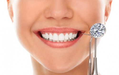 Có nên làm răng đính kim cương?
