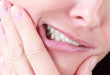 Bảo vệ răng từ những thói quen xấu hàng ngày