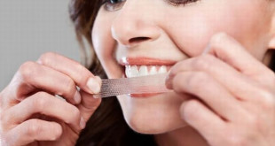 Cách sử dụng miếng dán trắng răng đơn giản hiệu quả nhất