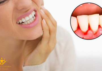Chân răng yếu, hỏng do đâu? – Cách bảo vệ chân răng hiệu quả